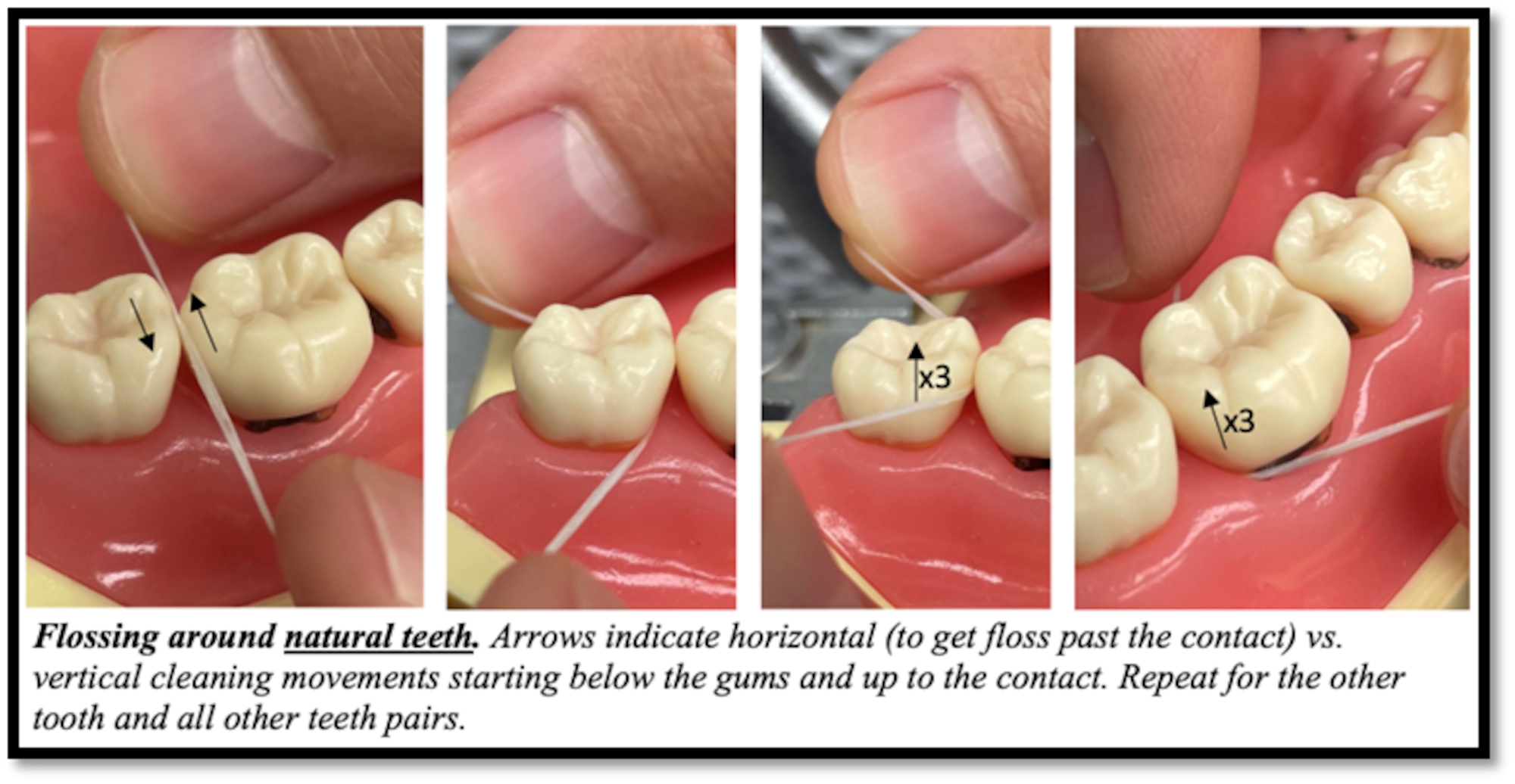 # Why Is Flossing Important for Your Oral Health?