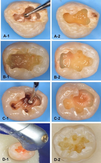 # What Is the Function of Dentin in Teeth?