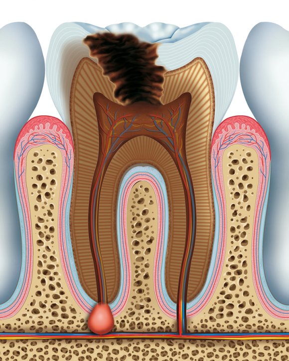 # What Is the Structure of a Tooth?