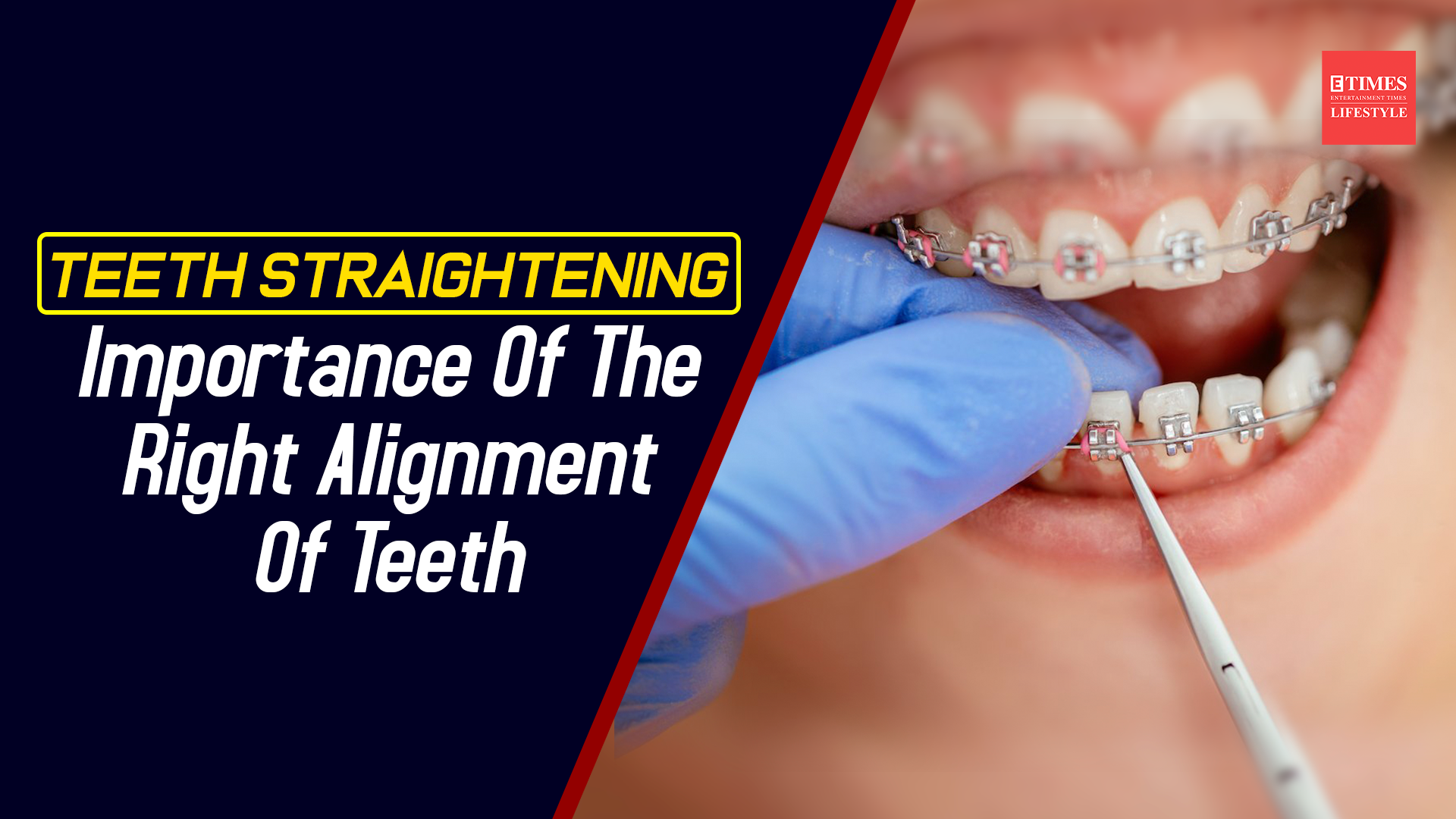 # How Do Teeth Interact with the Rest of the Mouth?