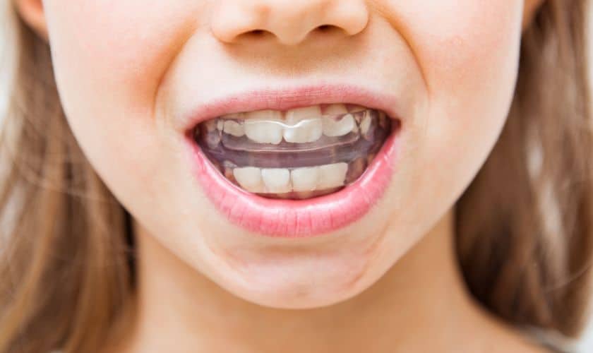 # What to Know About Tooth Types and Orthodontics