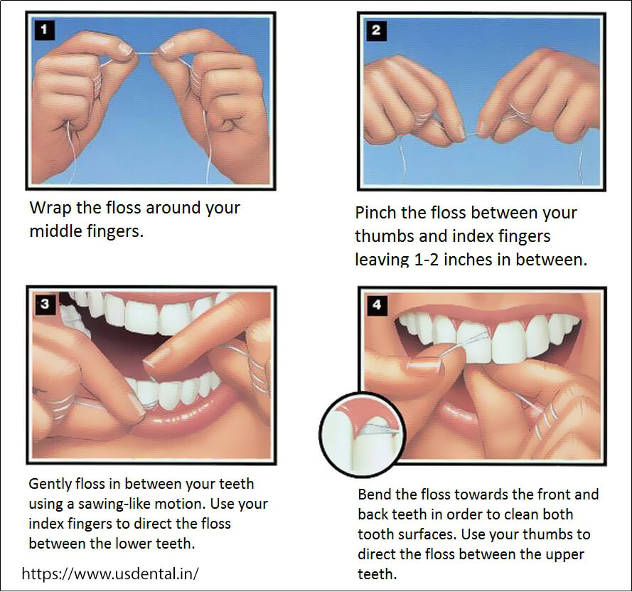 # The Role of Flossing in Preventing Tooth Decay