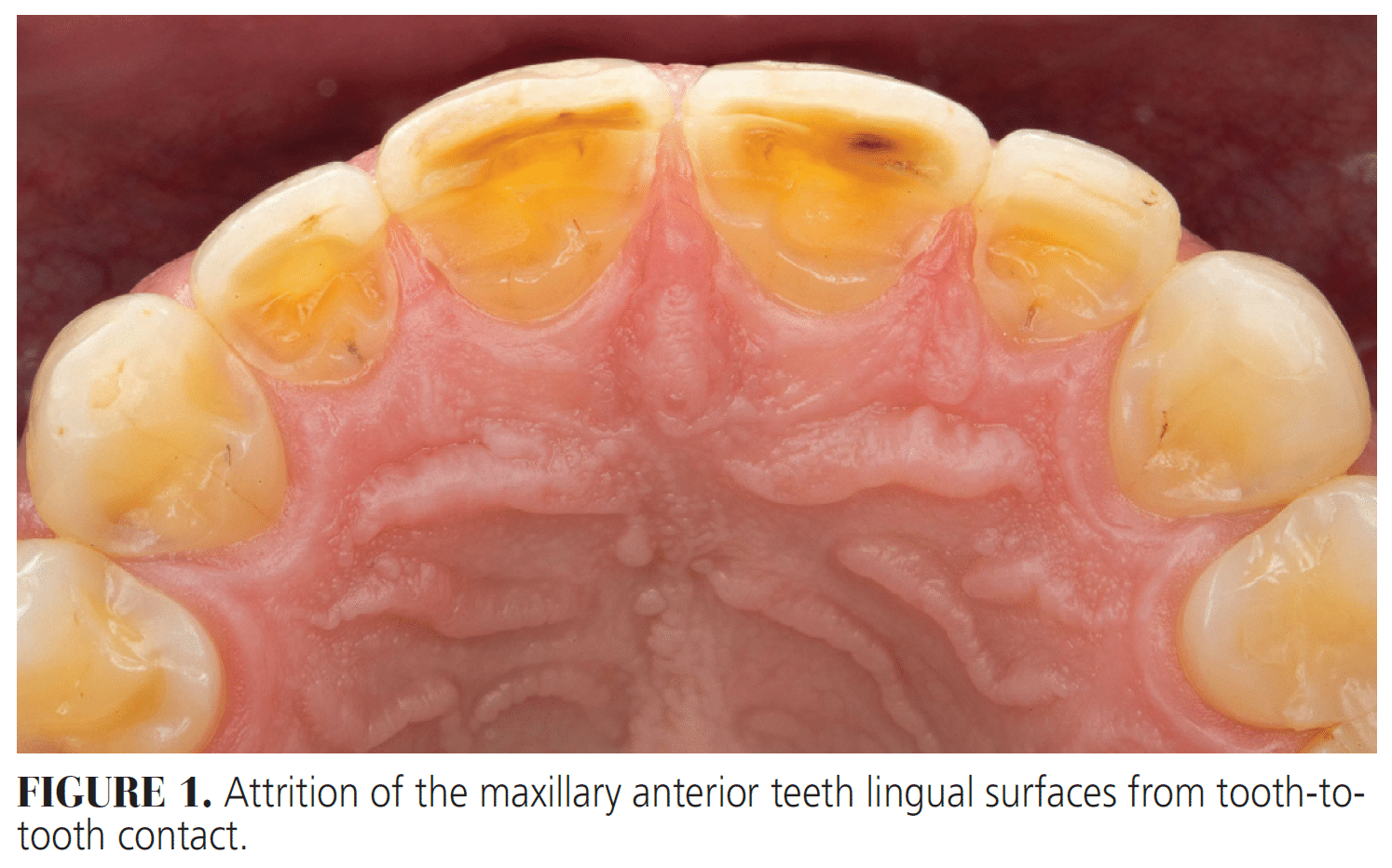 # How to Recognize Abnormal Teeth Types