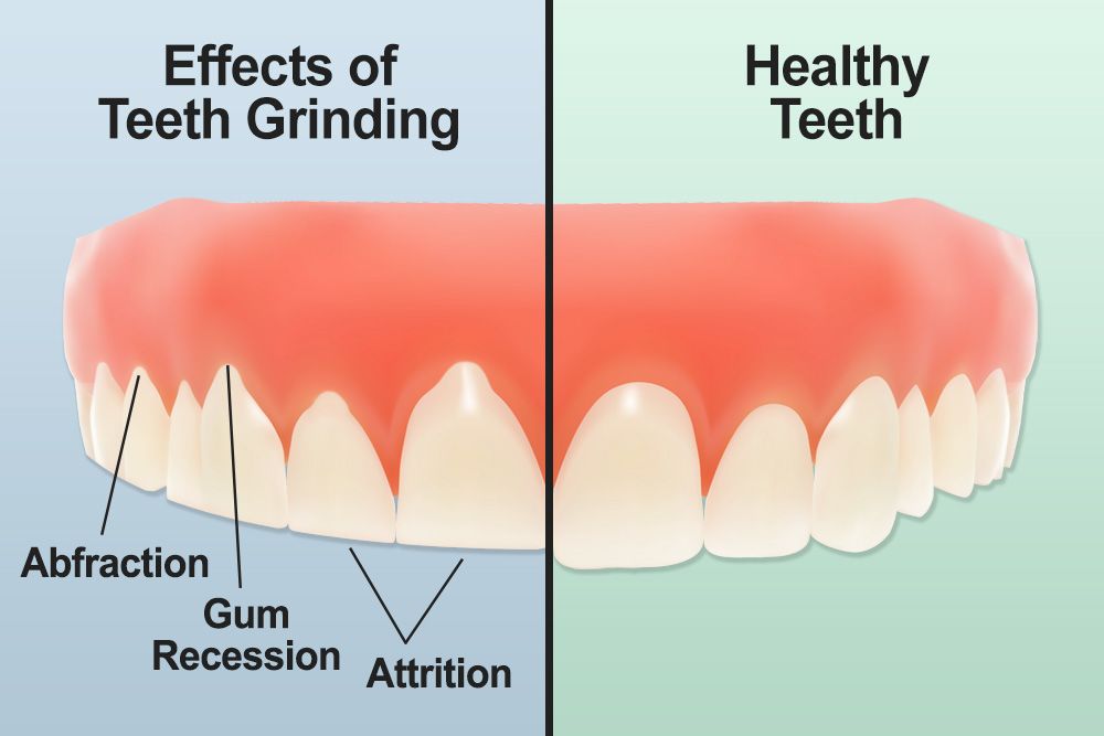 # How Does Tooth Anatomy Affect Dental Health?