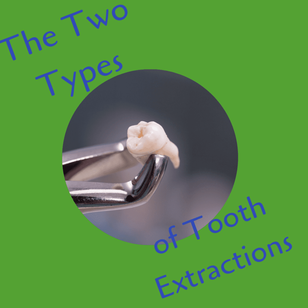 teeth extraction