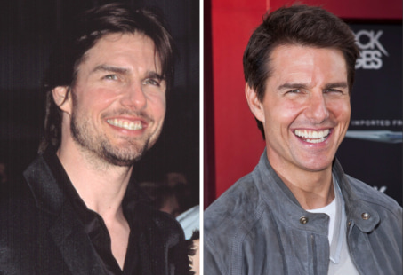 Tom Cruise Teeth