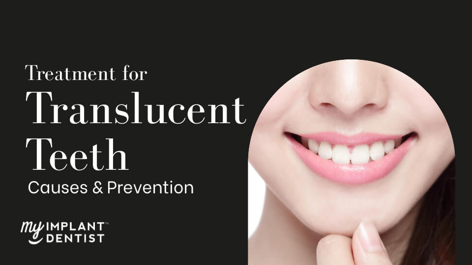 # When to Consult a Dentist About Teeth Growth Concerns