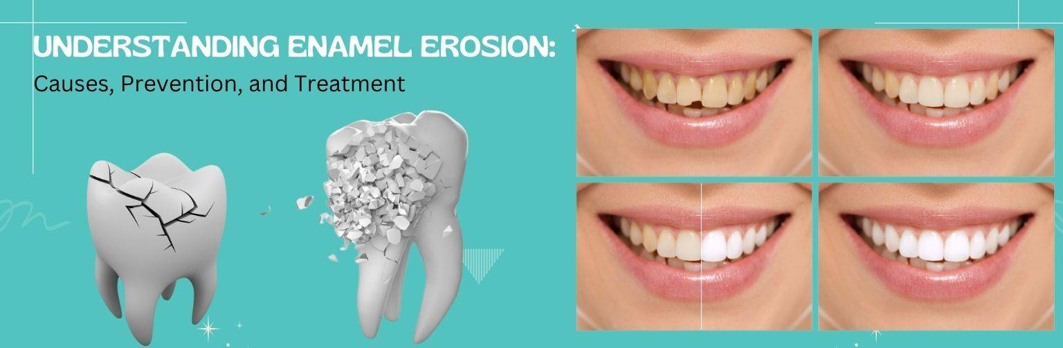 # What Is the Role of Enamel in Teeth Anatomy?