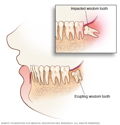 # Molars: The Powerhouses of Chewing