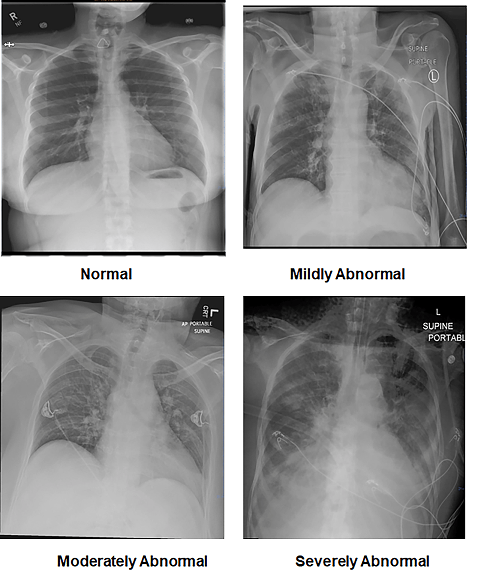 # How Does Tooth Anatomy Relate to Dental X-Rays?