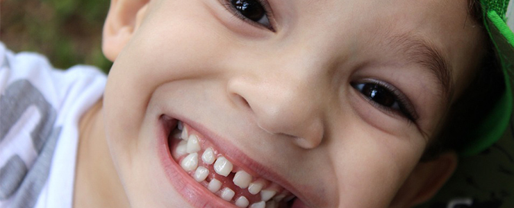 # Differences Between Baby Teeth and Adult Teeth