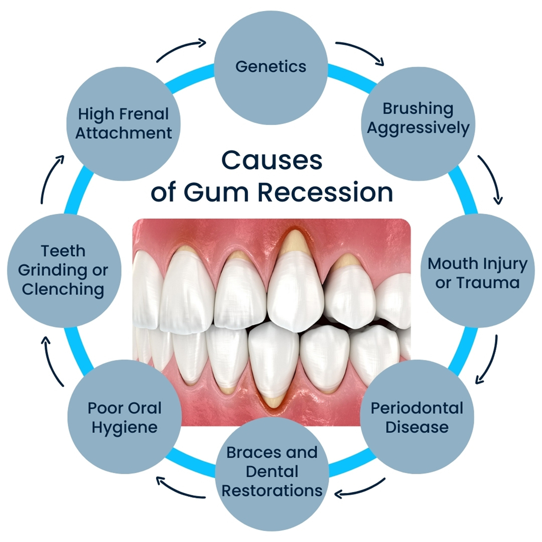 # What to Do If Flossing Causes Pain?