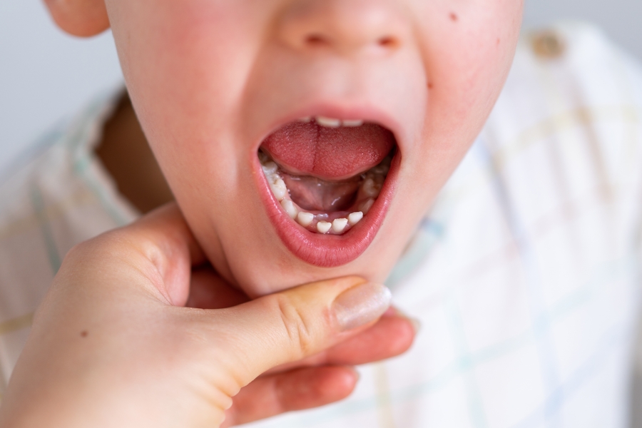 # How Do Teeth Form During Childhood?