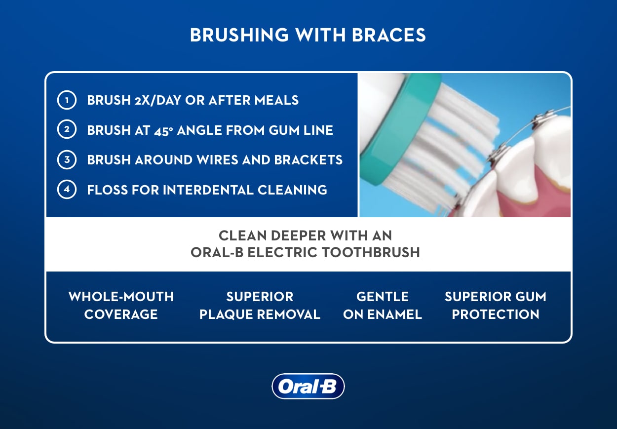 # How to Brush Your Teeth with Braces