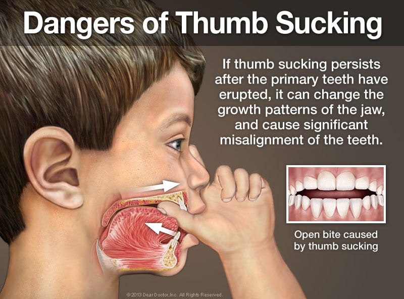 # The Relationship Between Teeth Growth and Jaw Development