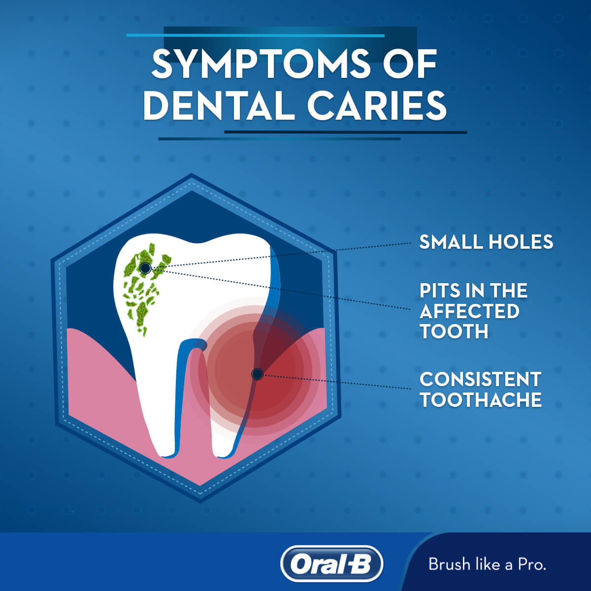 teeth caries