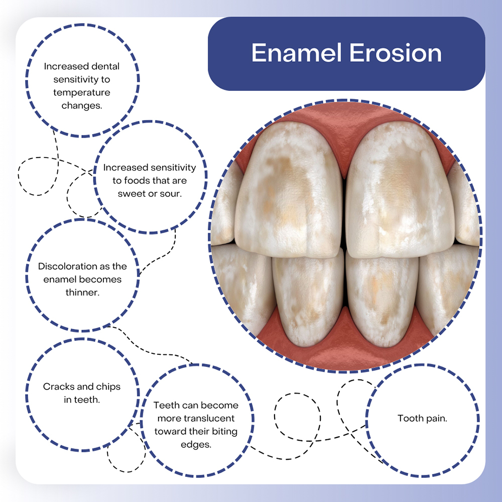 # What Is the Role of Enamel in Teeth Anatomy?