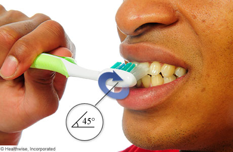 # What Is the Right Technique for Brushing Teeth?