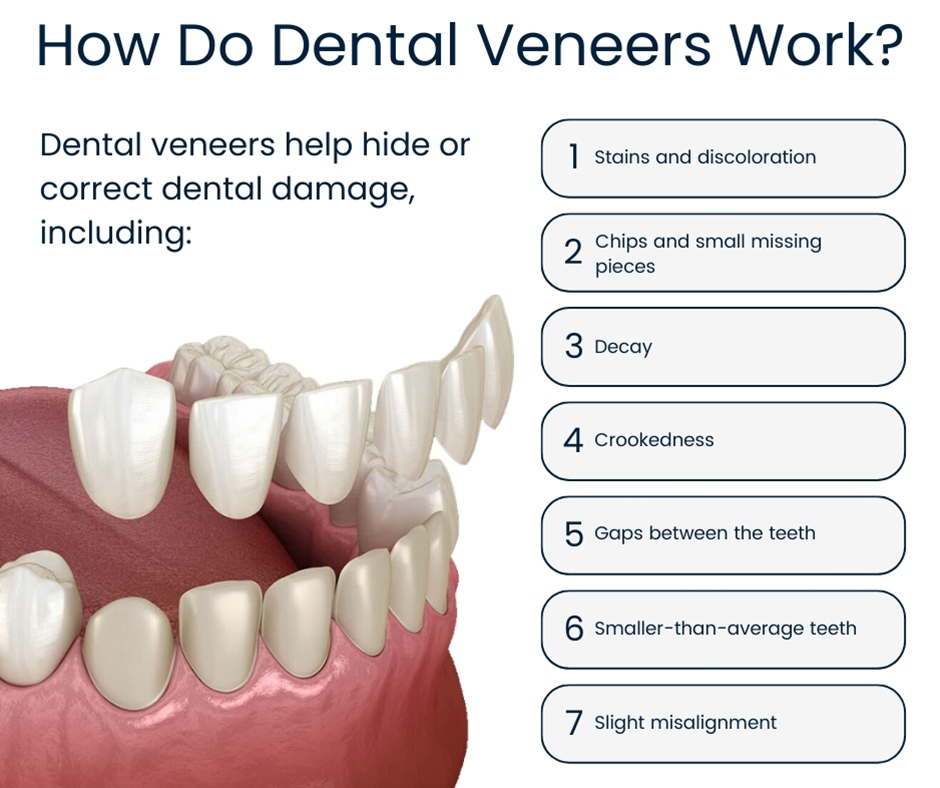 # How Do Teeth Interact with the Rest of the Mouth?