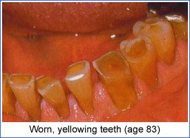 # How Do Teeth Adapt to Different Functions?