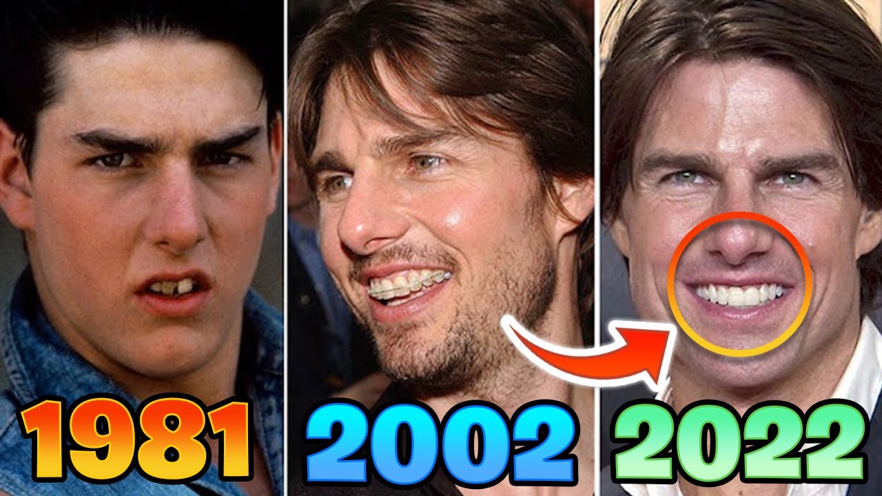 Tom Cruise teeth