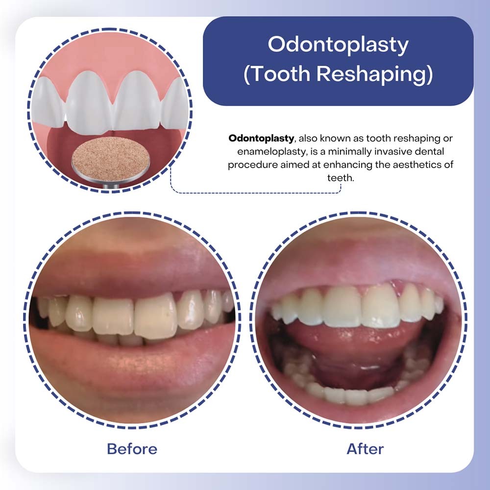 # When to Consult a Dentist About Teeth Growth Concerns