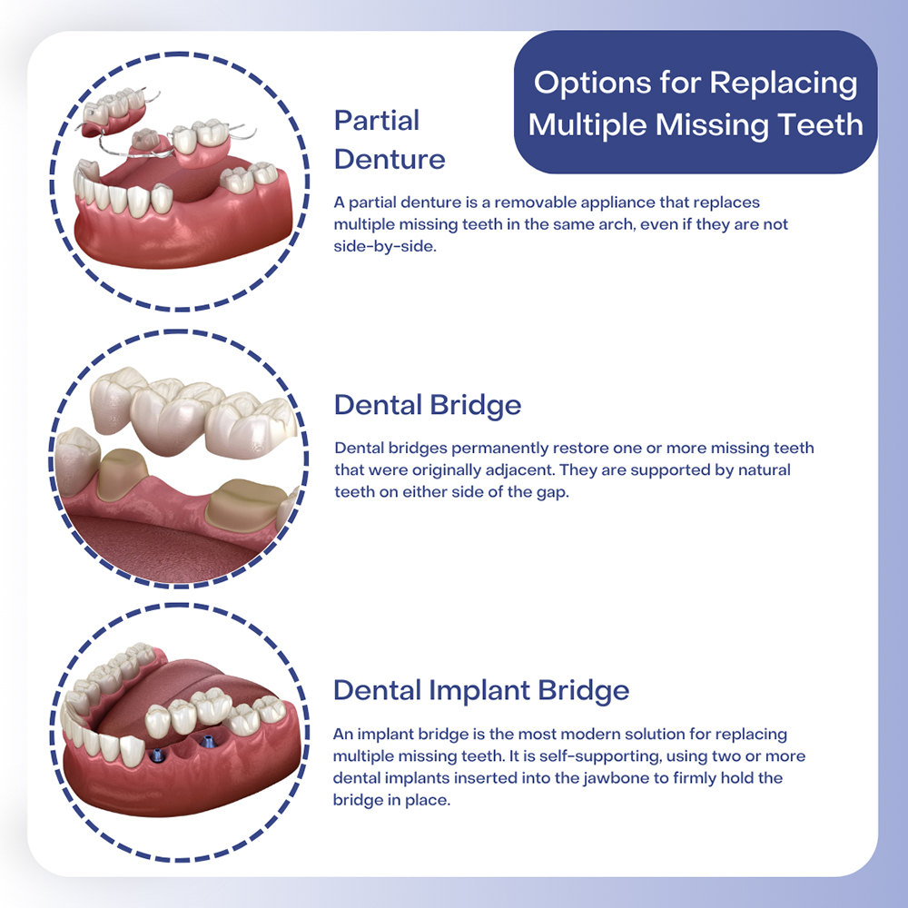 # What Is the Structure of a Tooth?