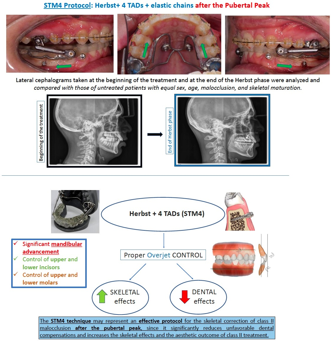 # How Do Teeth Types Change With Dental Treatments?