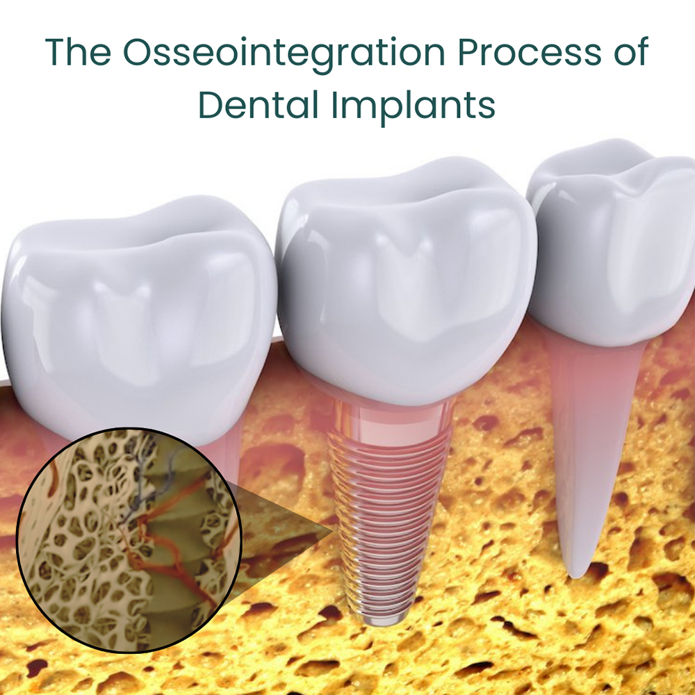 # When to Consult a Dentist About Teeth Growth Concerns