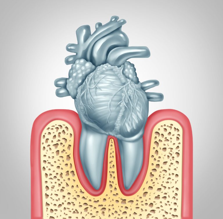 How Long Can You Leave a Cavity Untreated? Risks Explained