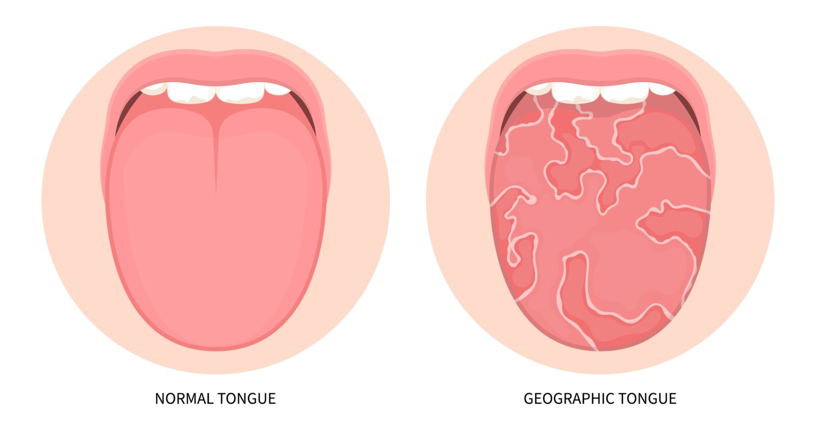 # What Are the Anatomical Variations in Teeth Among Different People?