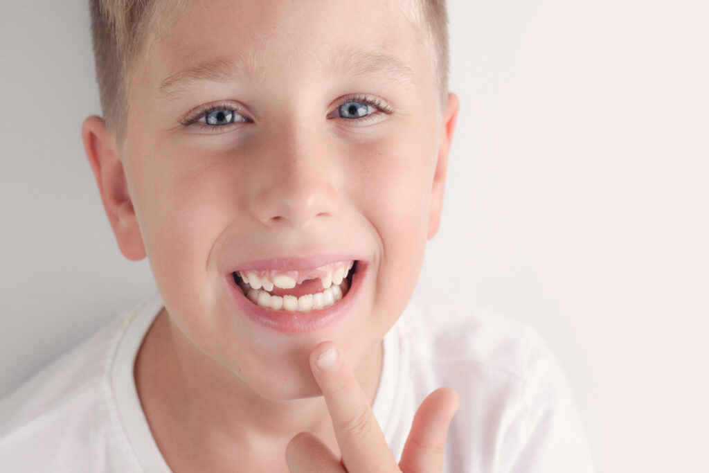 # Monitoring Your Child’s Teeth Growth at Home