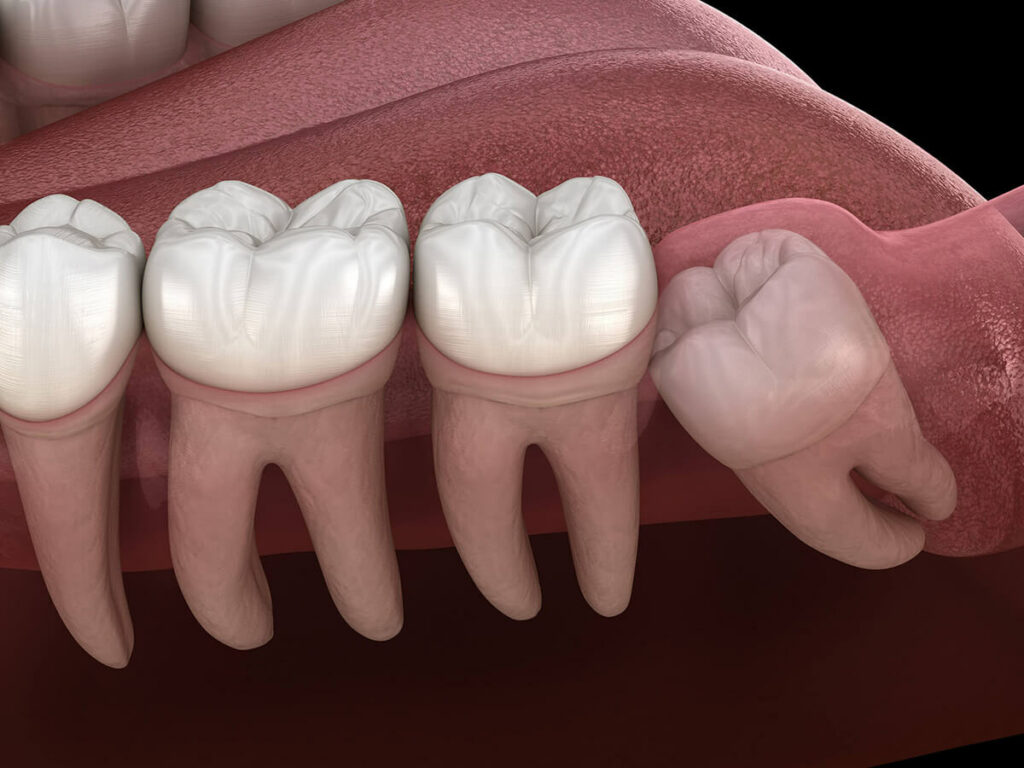 # What to Expect During Teeth Growth Phases