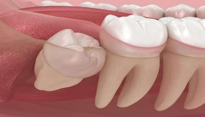 # Common Teeth Growth Issues and Solutions